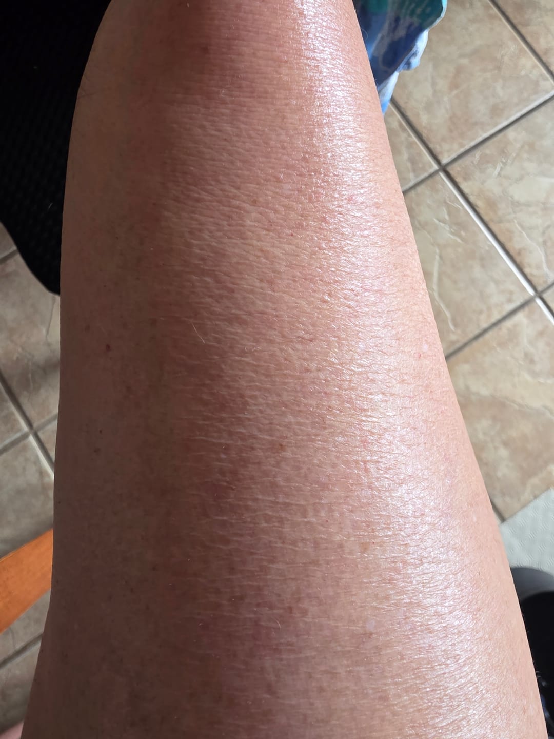 Customer photo review of Outdoor Body Extreme Cream