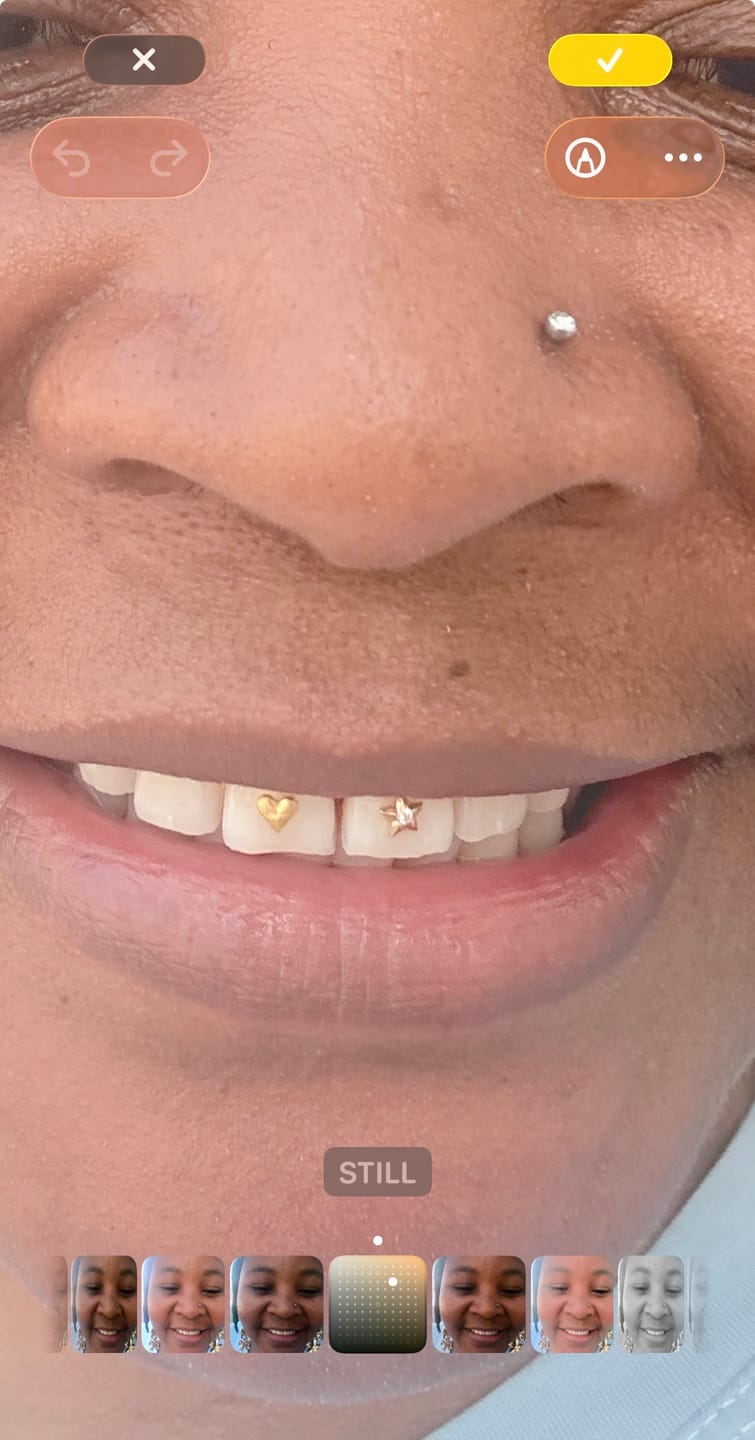 Customer photo review of Star w. Diamond Tooth Gem – 22k Gold | Twinkles