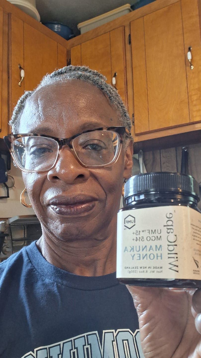 Customer photo review of UMF™ 15+ / MGO 514 Manuka Honey