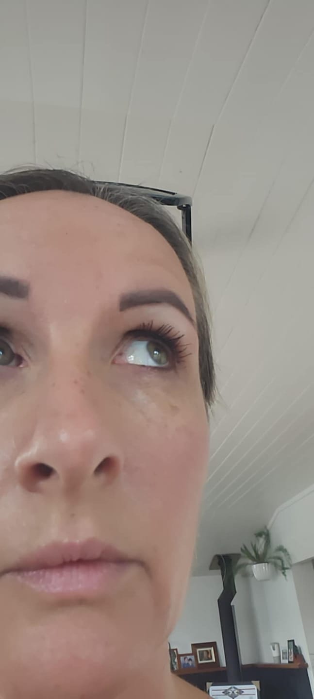 Customer photo review of Enhance® - Eyelash Growth Serum