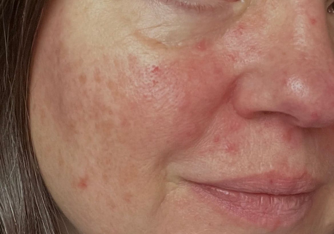 Customer photo review of Red Refresh