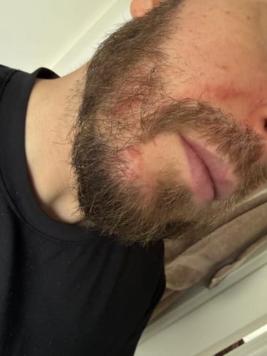 Résultat client
