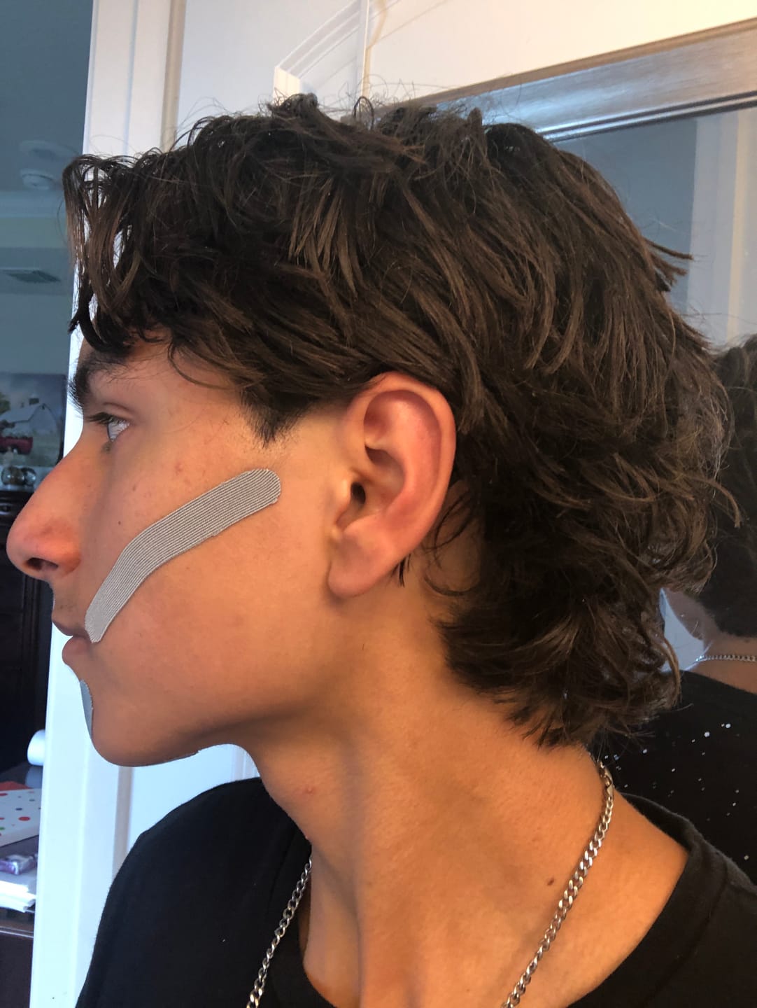 Customer photo review of Zygo Tape - Facial Sculpting & Anti-Aging Tape