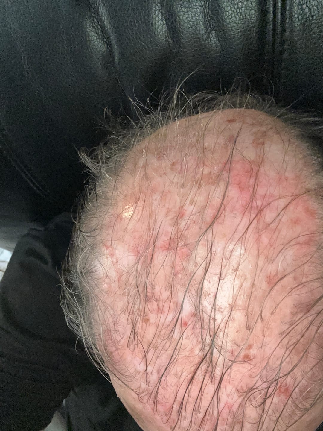 Customer photo review of SPARTAN™ - Root Activator Conditioner