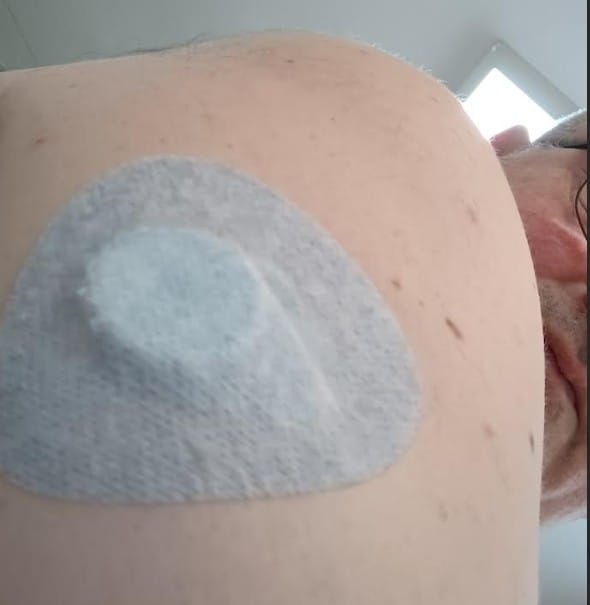 Customer photo review of Air Patch Original – כחול 20 יח׳