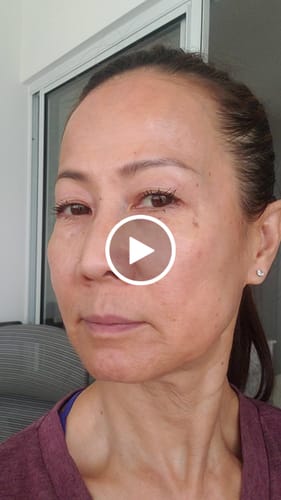 Customer video review of The Micro Infusion System™