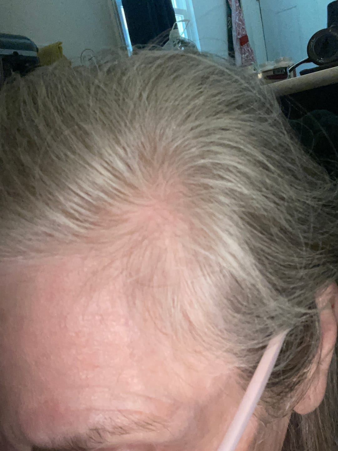 Customer photo review of Hair Growth Serum