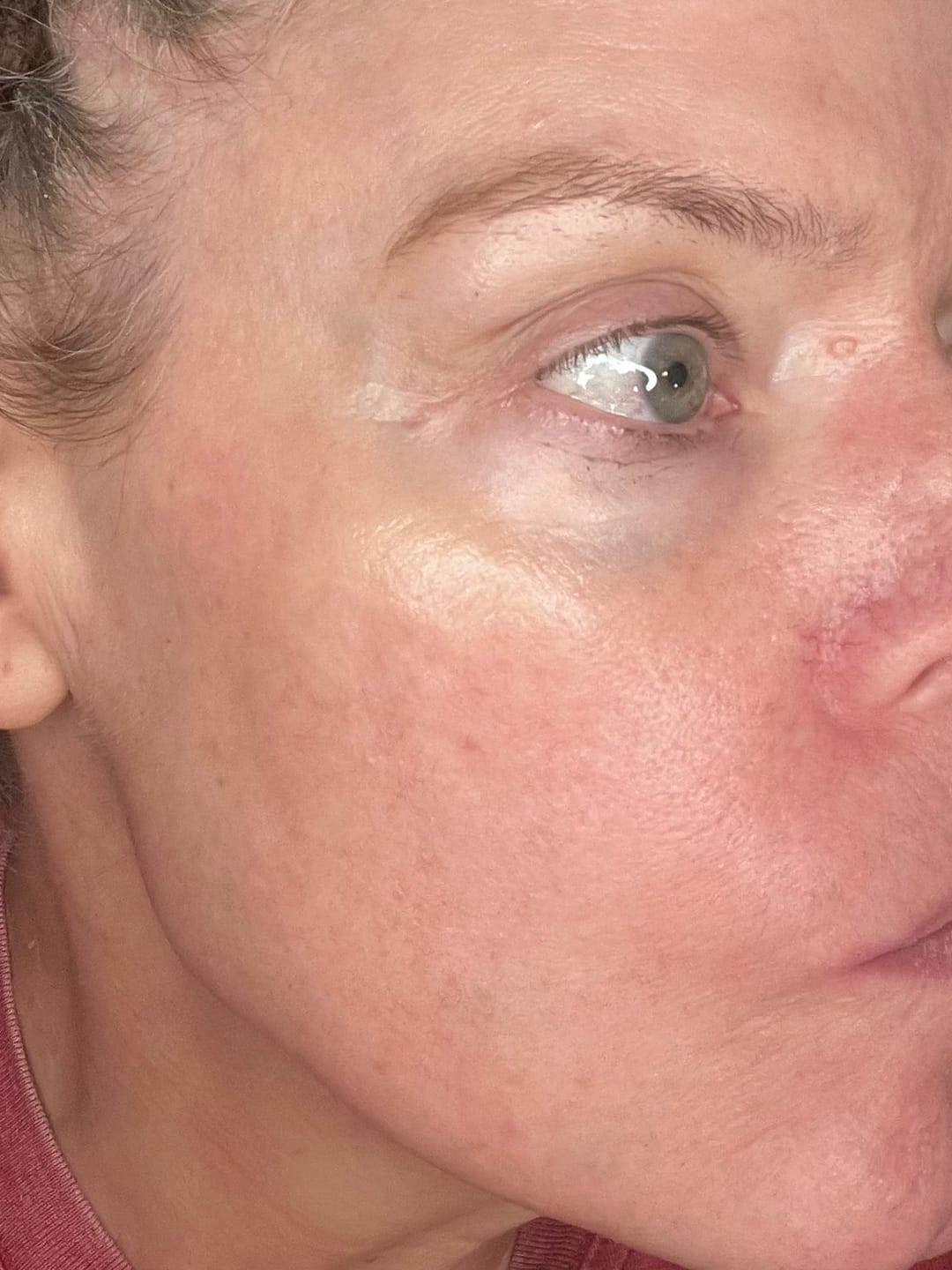 Customer photo review of Extra Strength Fading Kit