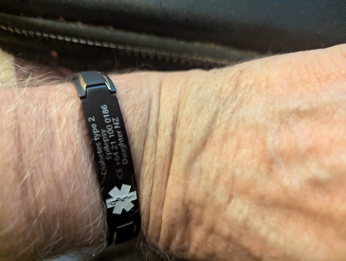 Customer photo review of Black & Gold Medical ID Bracelet