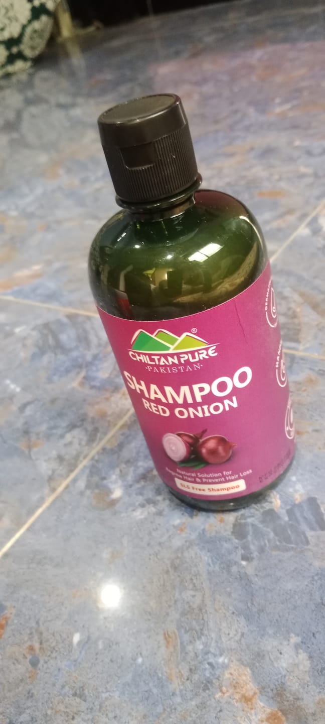 Customer photo review of Red Onion Shampoo Natural Solution for Regrow Hair & Prevent Hair Loss.