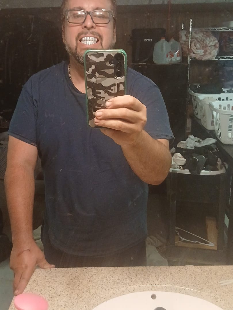 Customer photo review of 8 Tooth Standard Iced Grillz