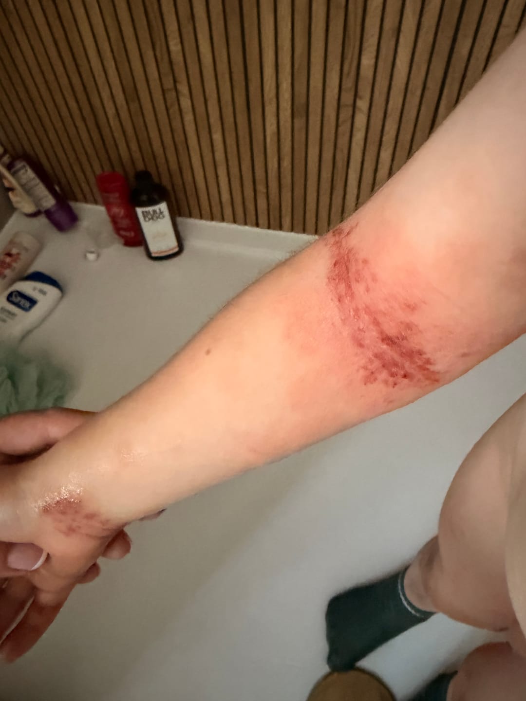 Customer photo review of Grass-Fed Tallow Body Balm | Cold Weather Protection