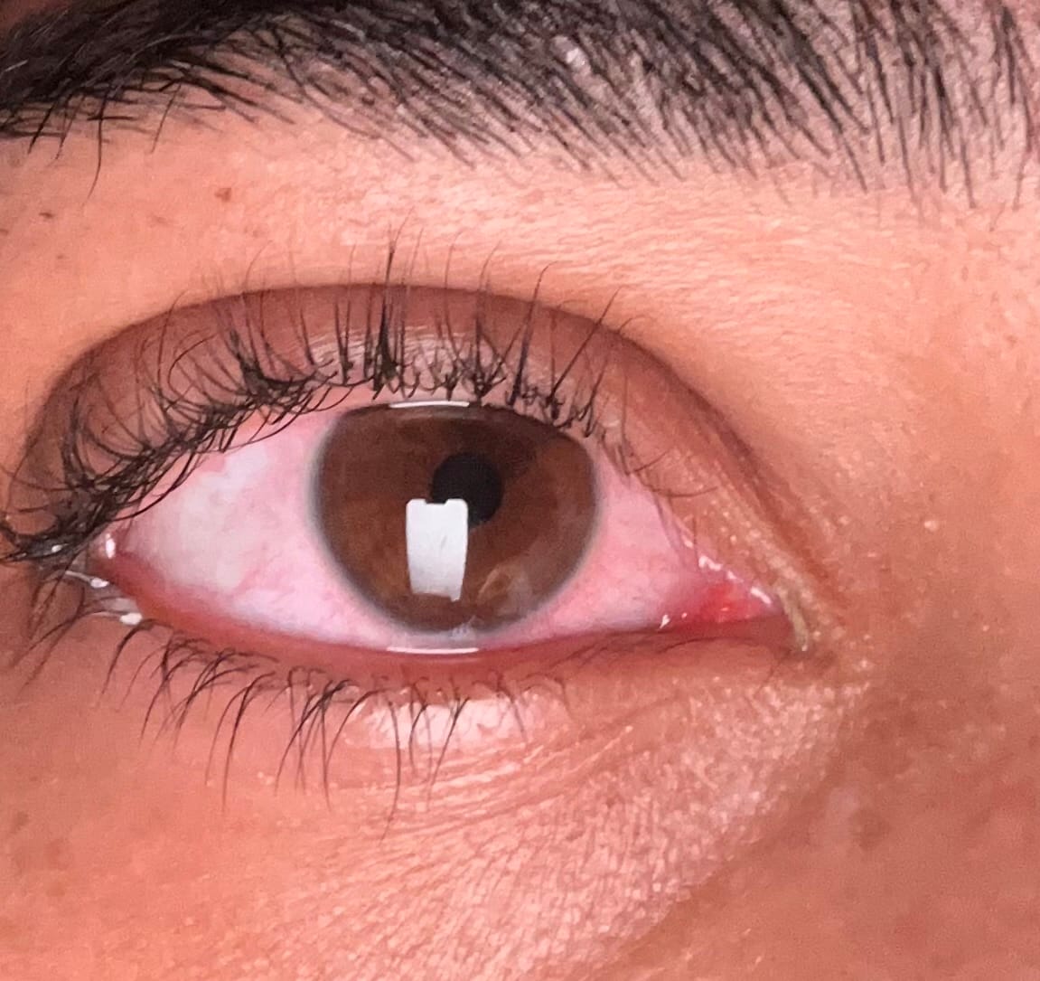 Customer photo review of Ruri Brown Prescription Coloured Contact Lenses