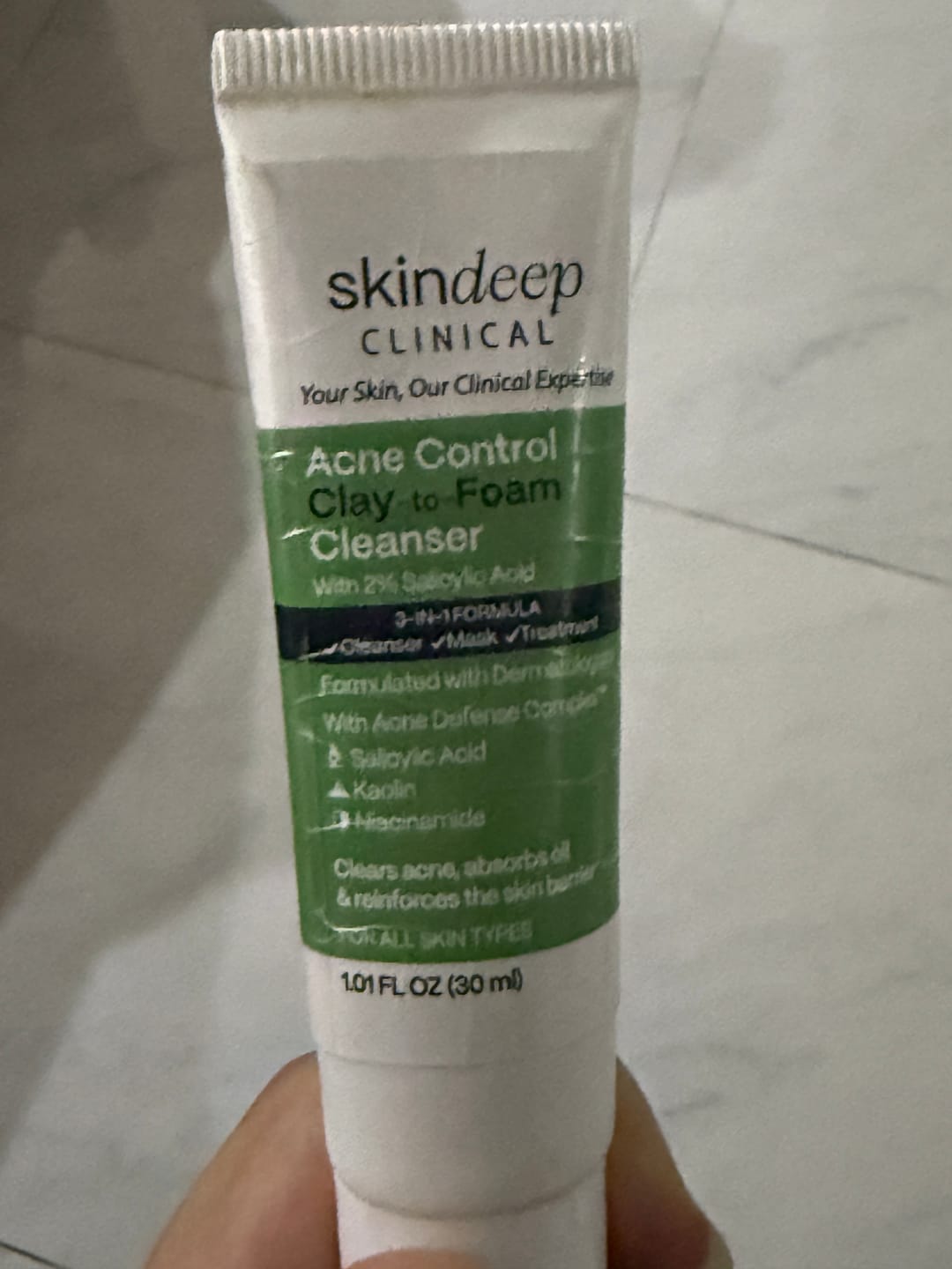 Customer photo review of Acne Control Clay-to-Foam Cleanser