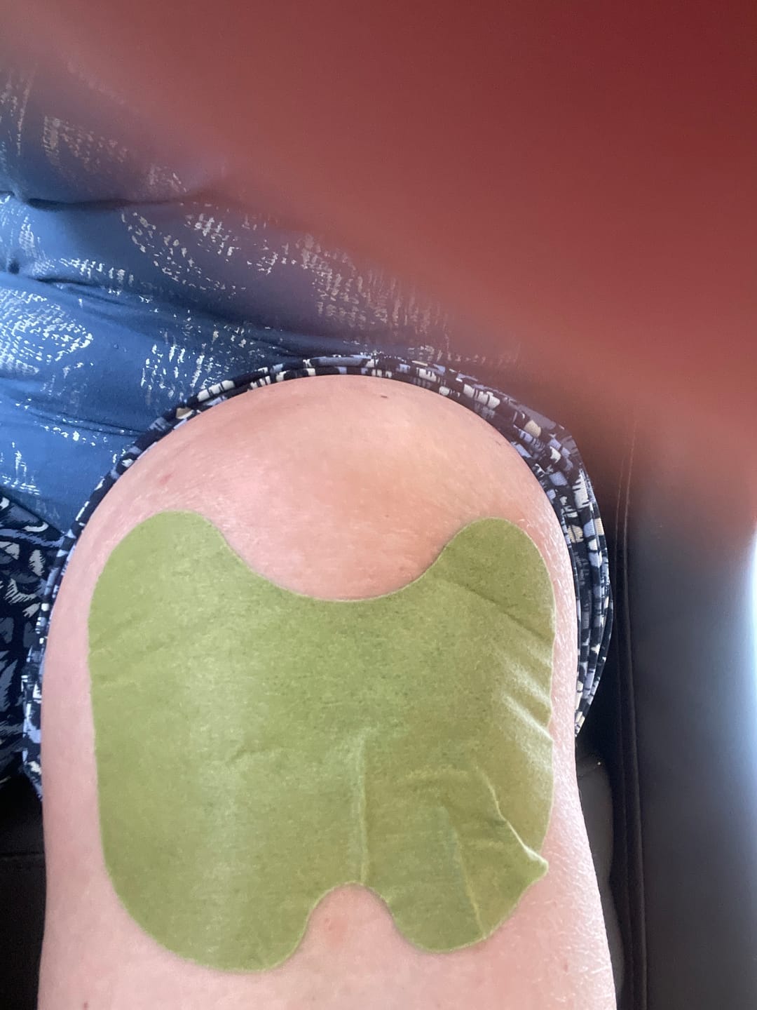 Customer photo review of Patchs anti-douleur