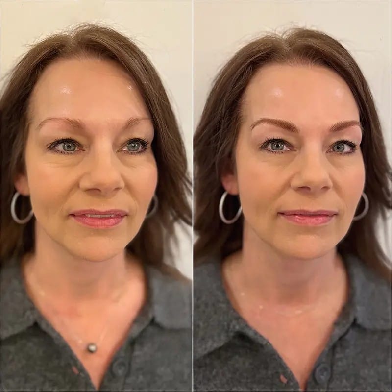 Customer photo review of Linea Brow Fection- Undvik dyra salongsbesök