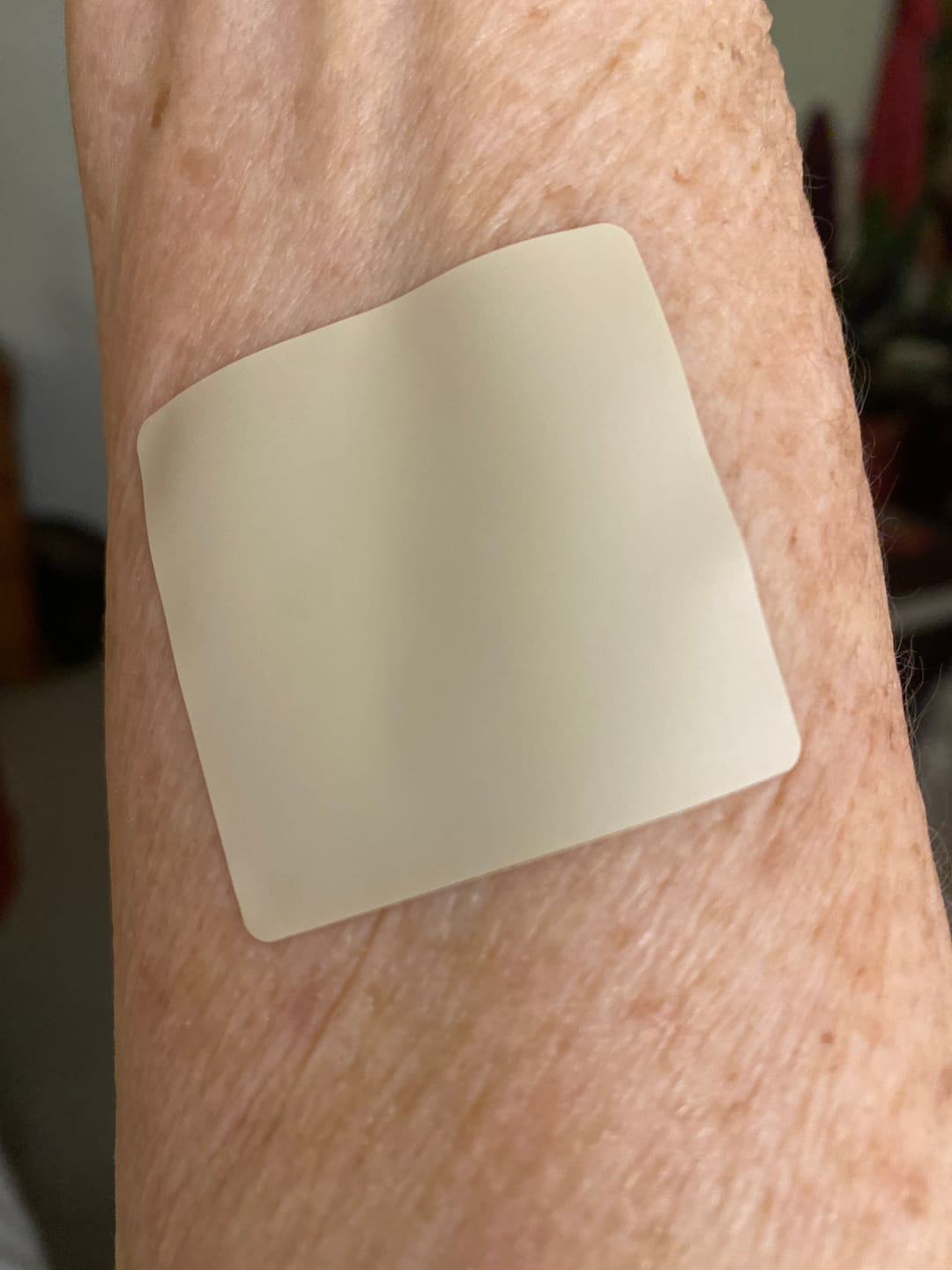 Customer photo review of mussage 8 Hour Sleep Patch