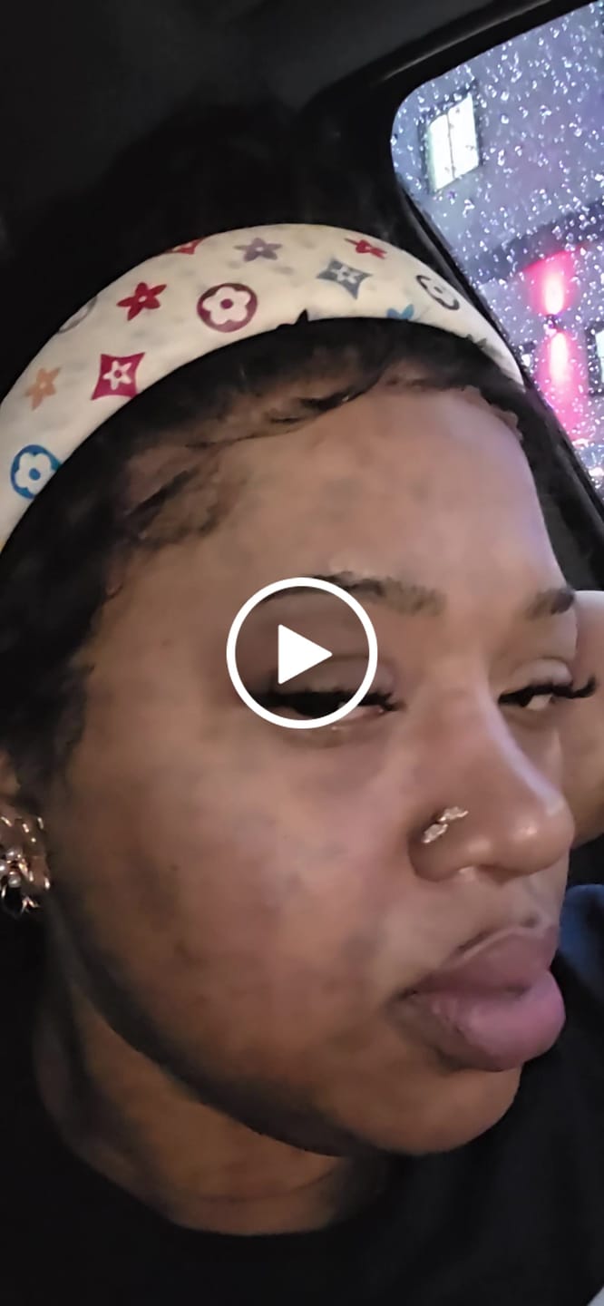 Customer video review of VB-Care N°43