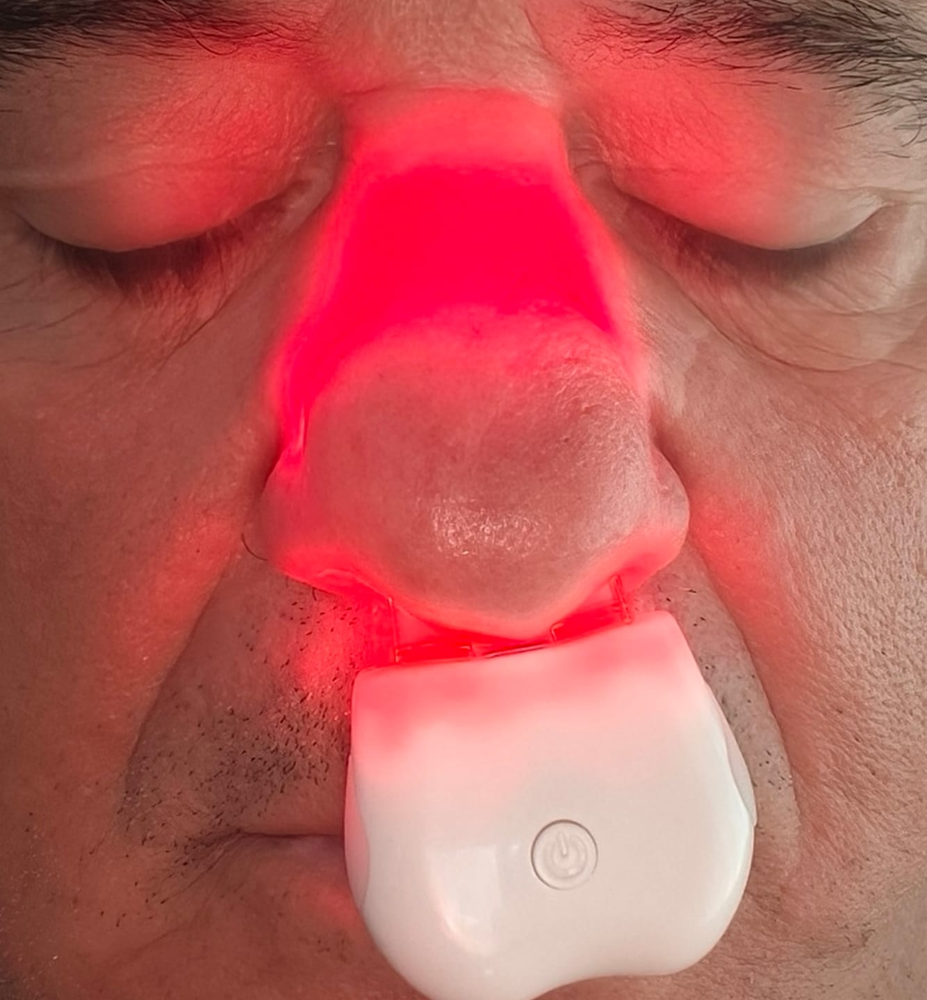 Customer photo review of Dispositivo nasal luz roja