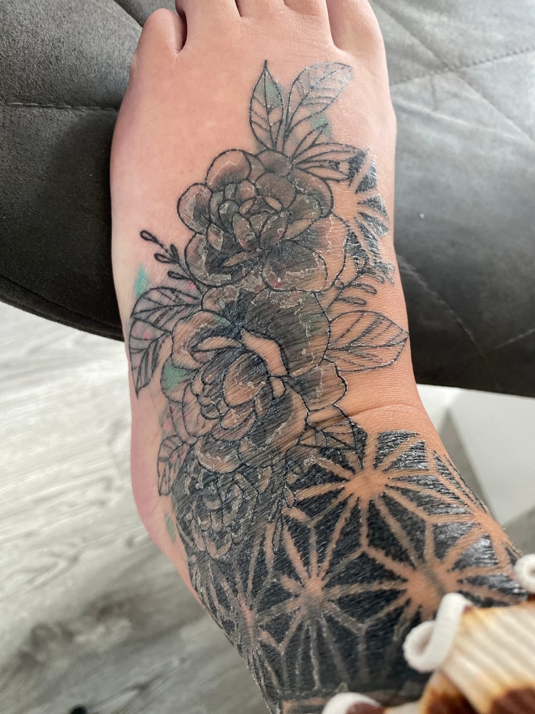 Customer photo review of TattooNumbx Numbing Cream