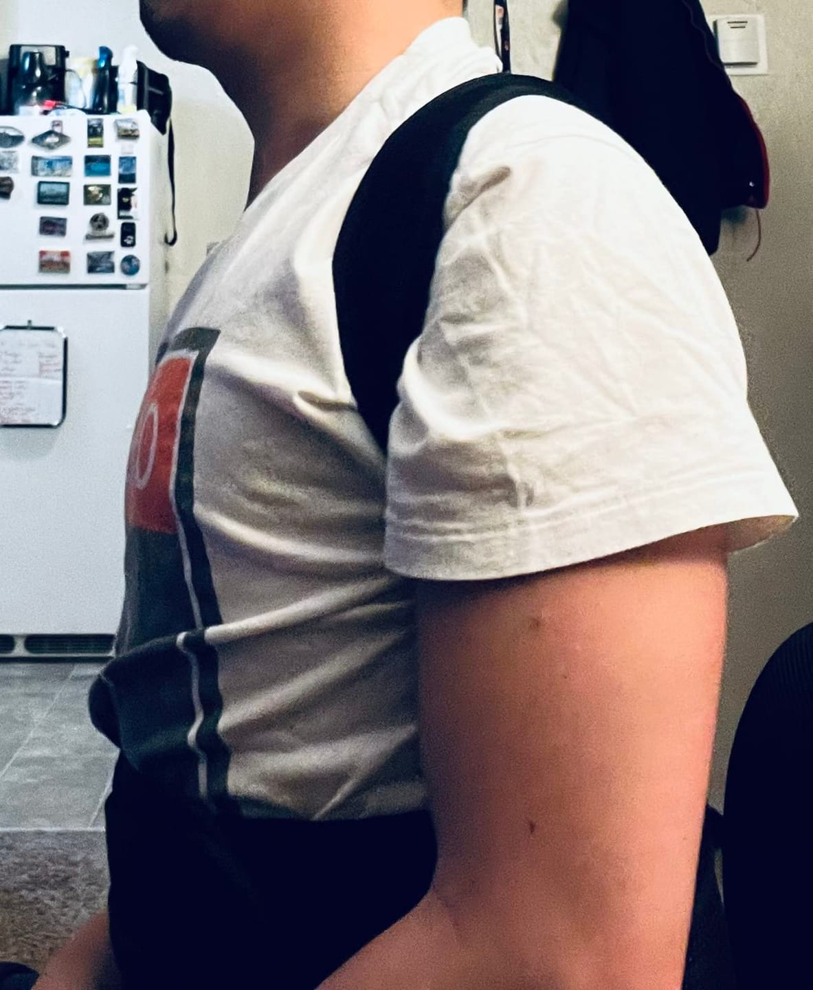 Customer photo review of OrthoRise Posture Corrector