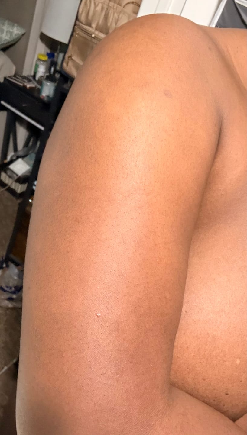 Customer photo review of Brightening Body Oil