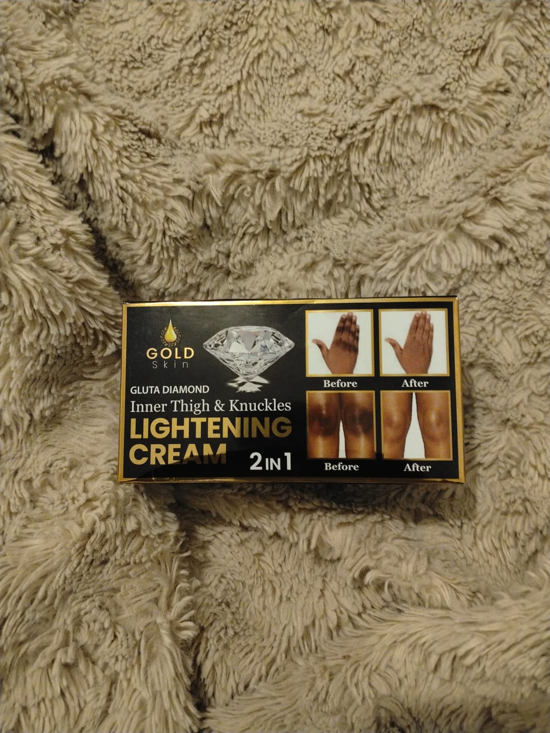 Customer photo review of Gluta Diamond Inner Thigh & Knuckles Lightening Cream