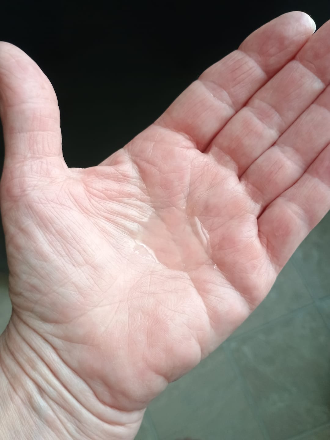 Customer photo review of CLEAN CLEANSER | CLEANSING GEL
