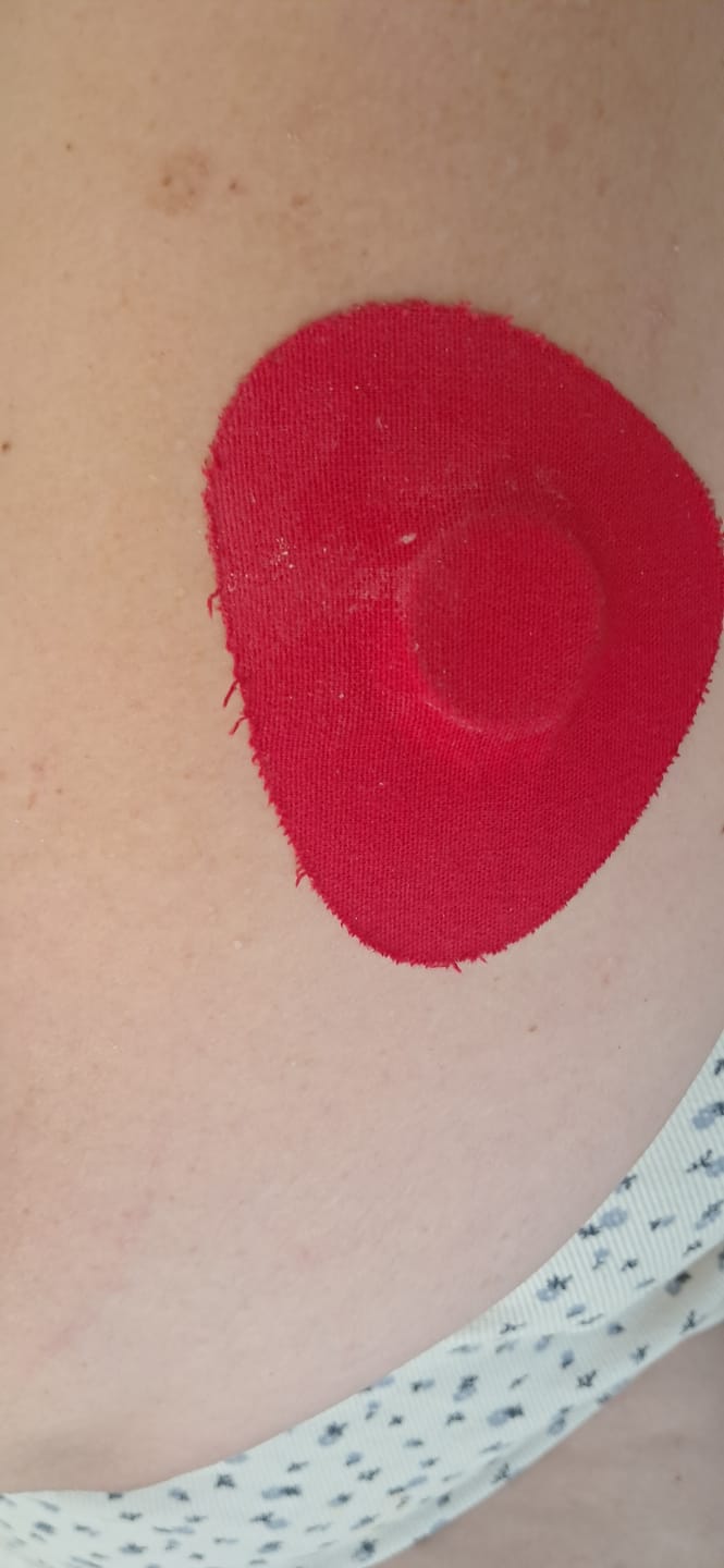 Customer photo review of Original Patch תפזורת 20 יח׳