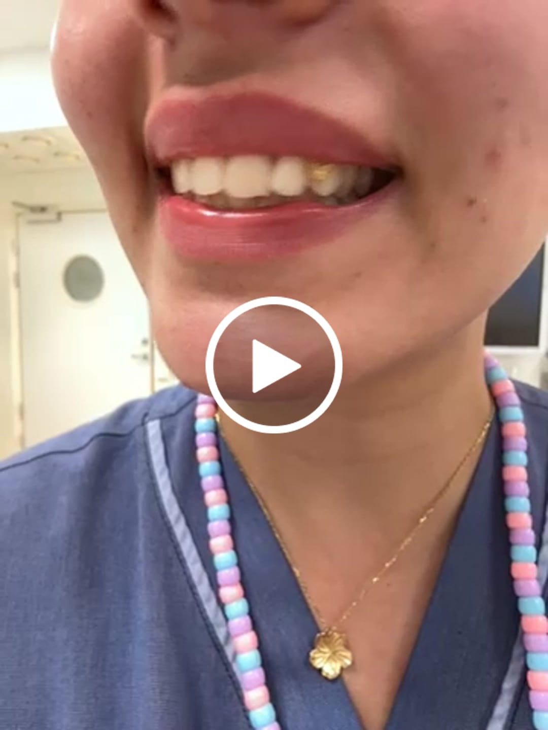 Customer video review of Butterfly Tooth Gem – 22k Gold | Twinkles