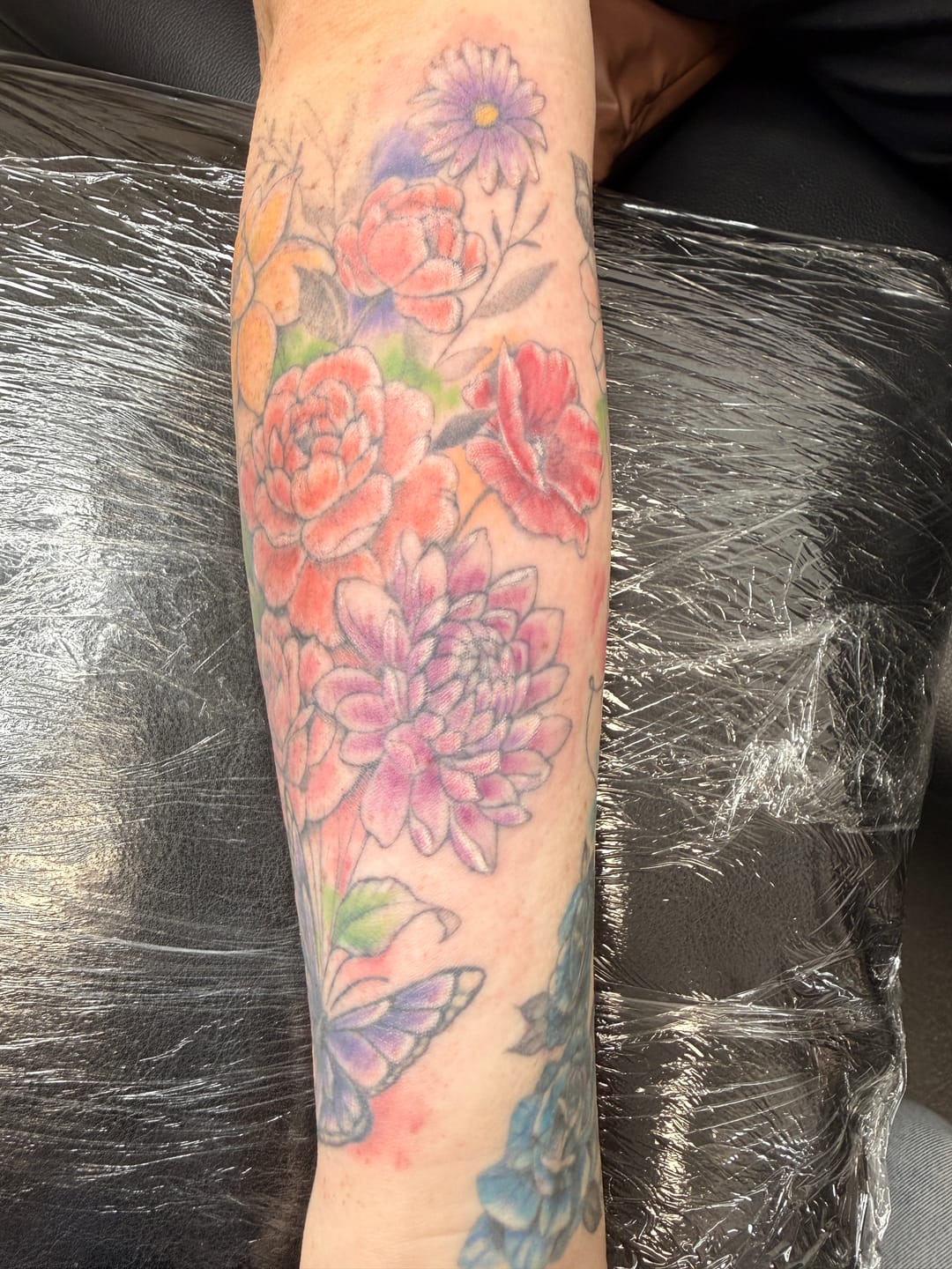 Customer photo review of TattooNumbx Numbing Cream