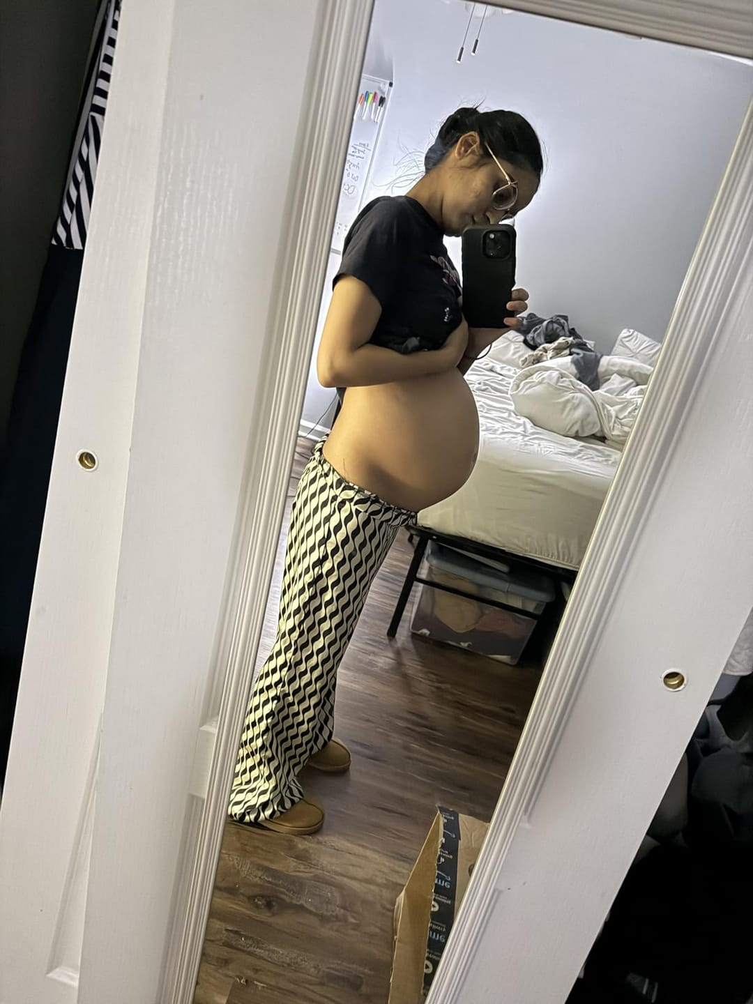 Customer photo review of Botanical Belly Oil™ - Stretch Marks