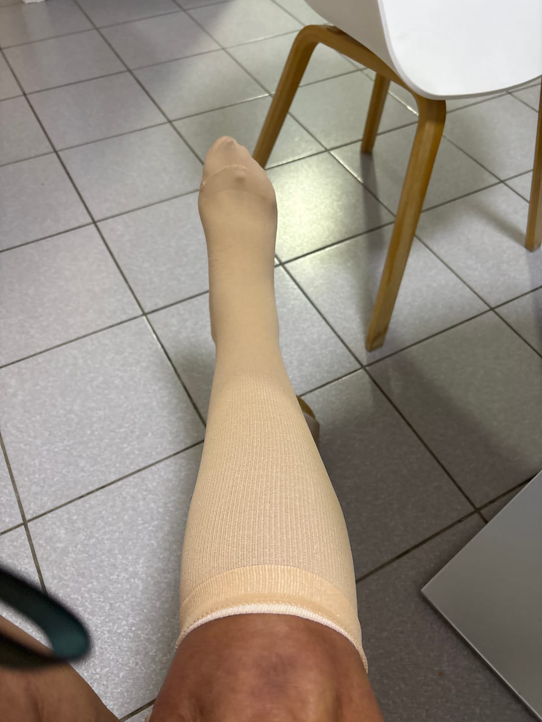 Customer photo review of EverSock™ Wide Compression Socks For Pain Relief
