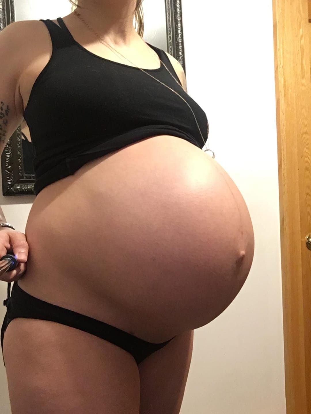 Customer photo review of Botanical Belly Oil™ - Stretch Marks
