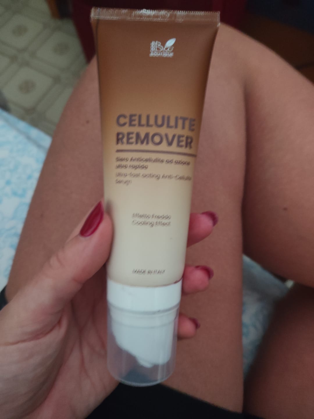 Customer photo review of Cellulite Remover
