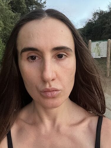 Customer photo review of Perfect Instant Face Tightener