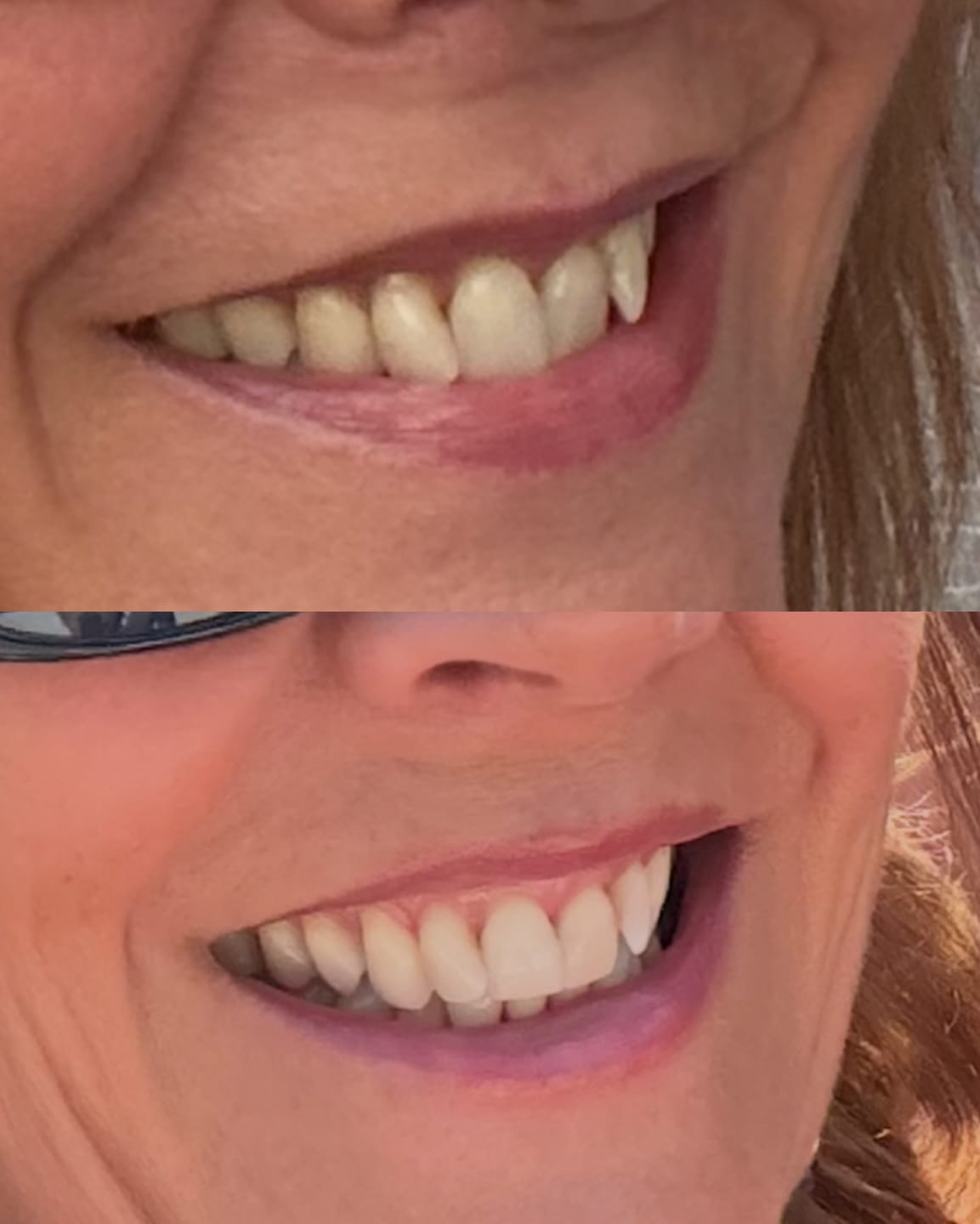 Customer photo review of Teeth Whitening Powder