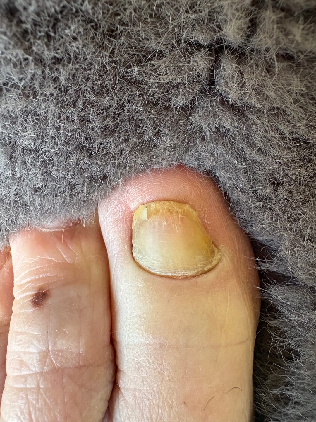 Customer photo review of Fungal Freedom