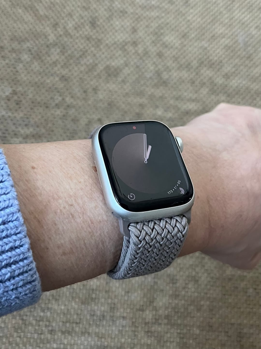 Customer photo review of arktisband Geflochtenes Apple Watch Armband "Casual" mit Magnetverschluss