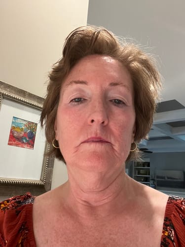 Reviewer showing a close-up of her face and the area around her mouth for a product review.