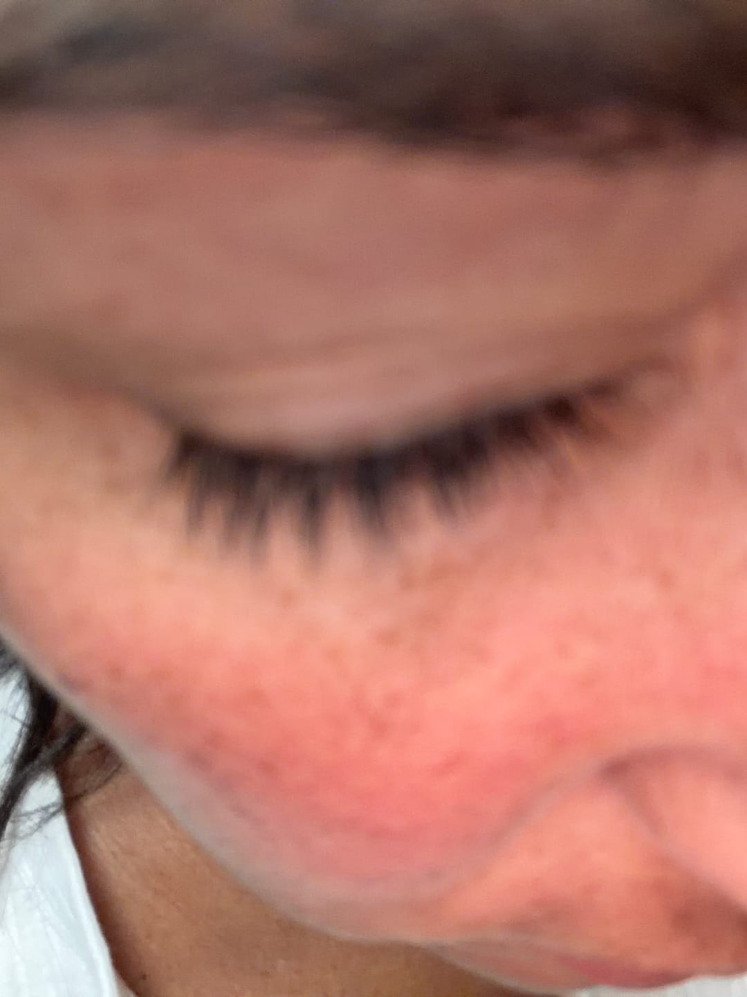 Customer photo review of Eyelash Serum