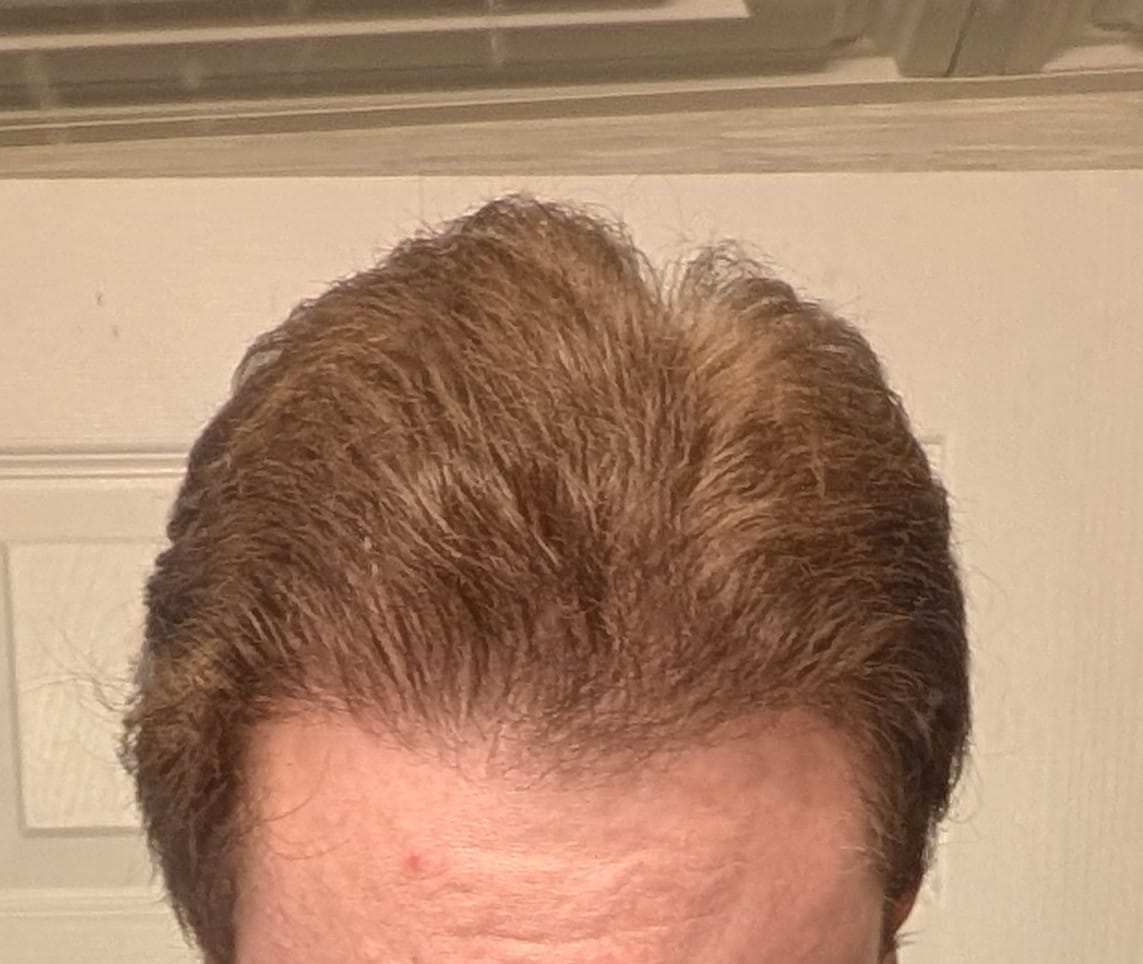 Customer photo review of Hair Thickening Shampoo