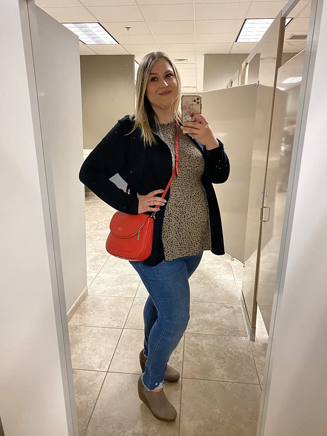 Customer photo review of 3x5 Inches Human Hair Toppers Mono Base Balayage Blonde #3/8/22
