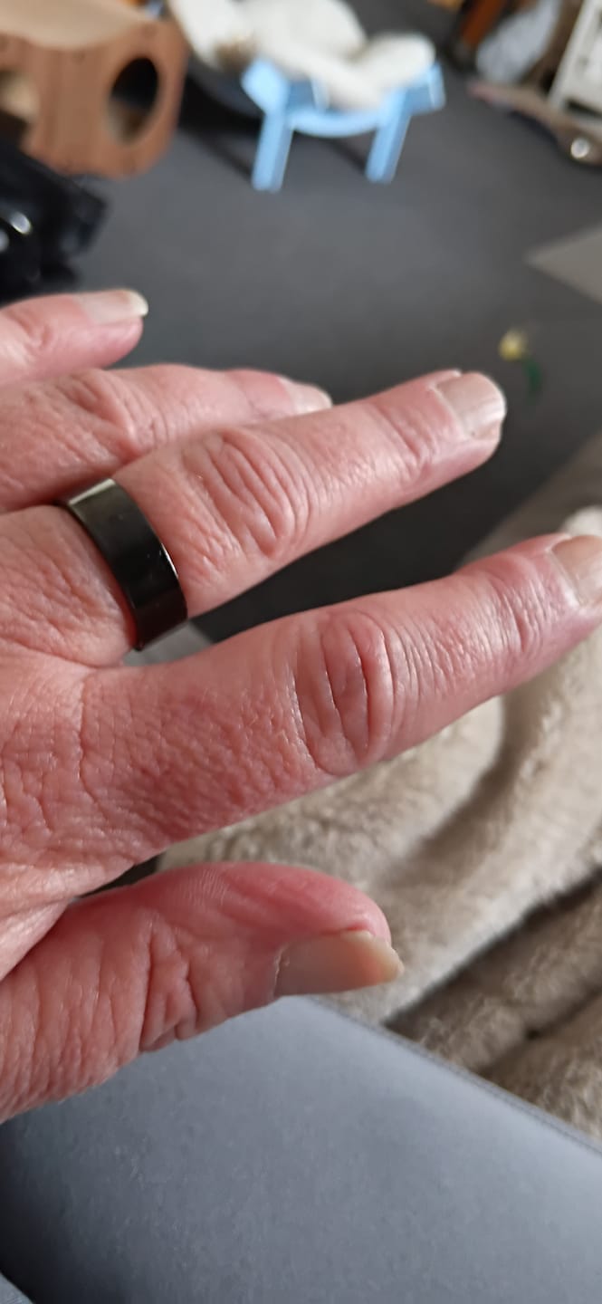 Customer photo review of Healing Ring