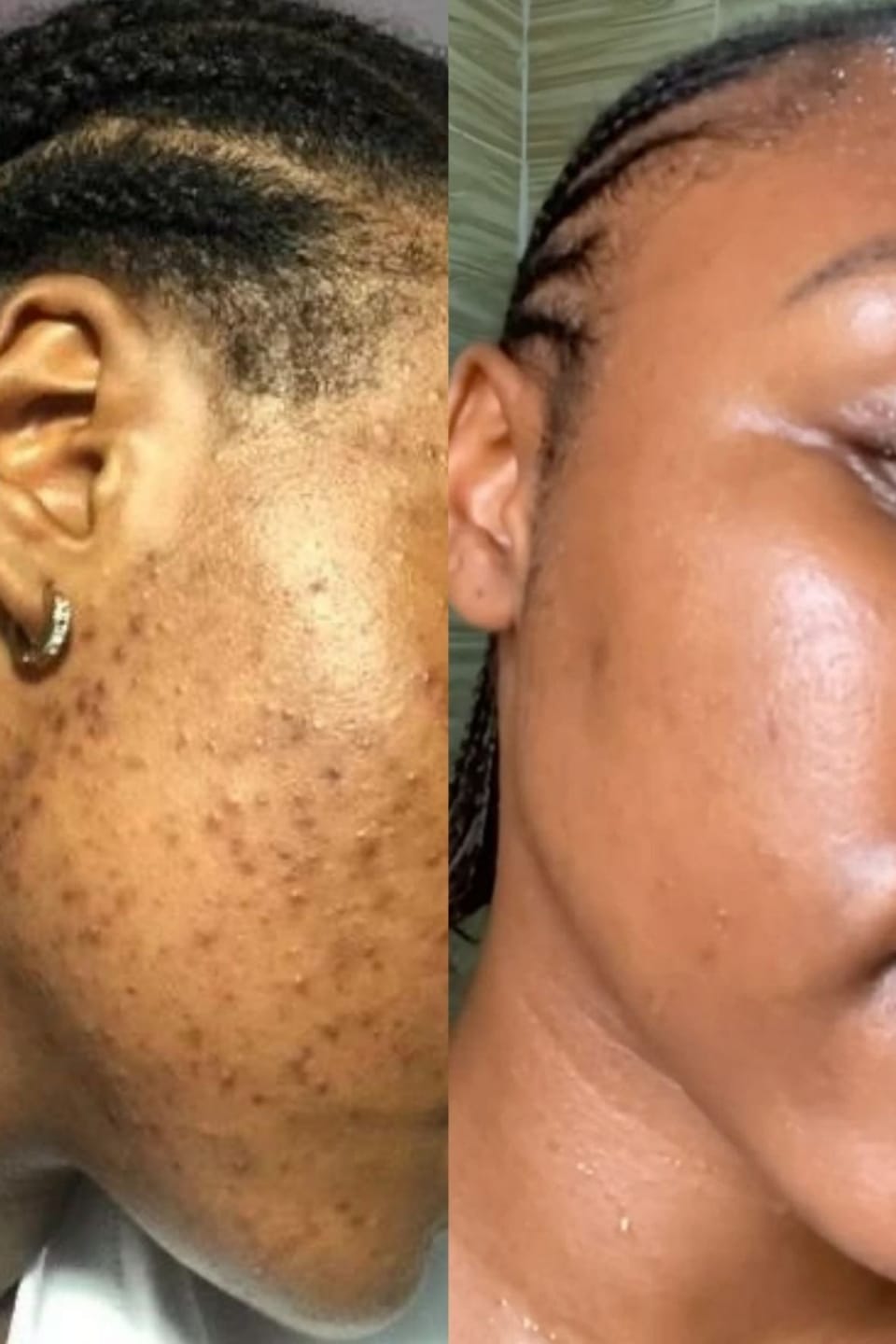 Customer photo review of GLOW FACE WASH