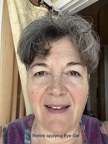 Customer photo review of Perfect Instant Face Tightener
