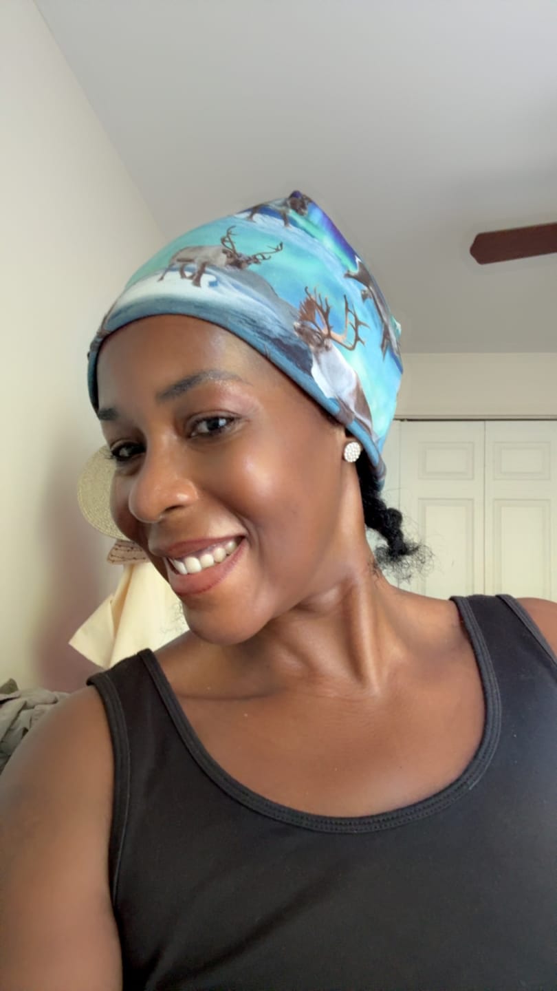 Customer photo review of So White Skin Perfector Dark Spot Corrector Gel 30ml