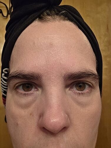 Customer photo review of Perfect Instant Face Tightener