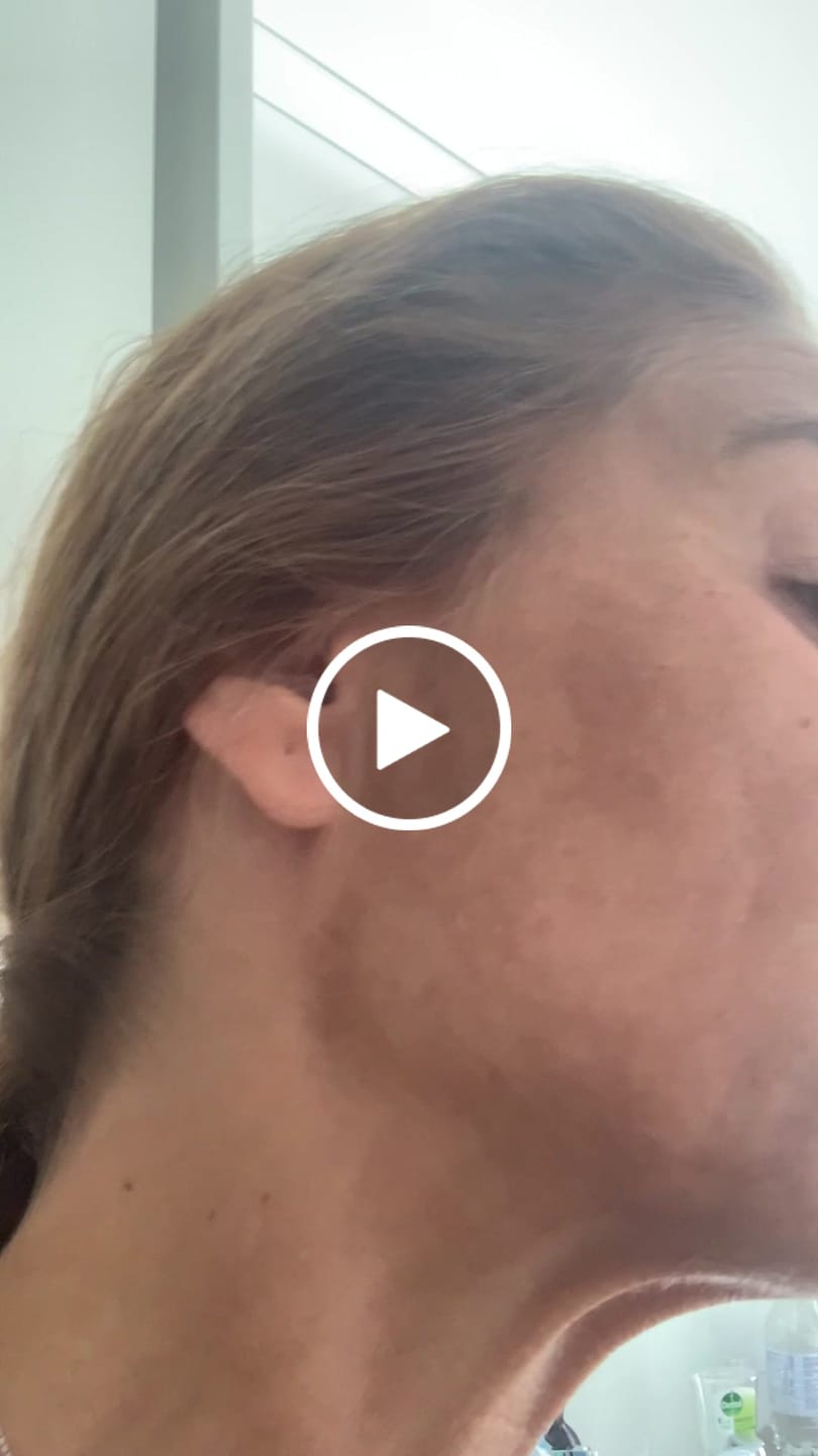 Customer video review of Natural Skin Lifting Serum | 30 ml