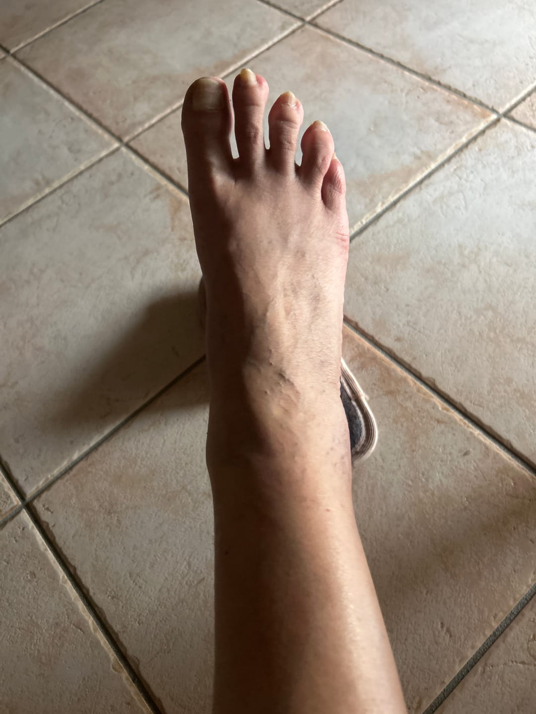 Customer photo review of Crema defaticante capillari